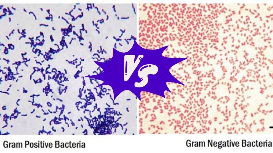 Gram-Positive and Gram-Negative Cells in Gram Stain - Sciencelab limited 