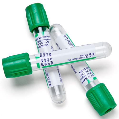 Lithium heparin tubes(green tops)
